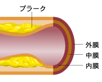 動脈硬化検査