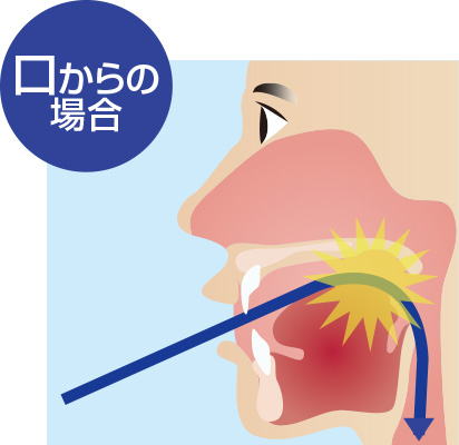 口からの場合